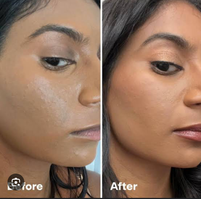 Skin Whitening Cream