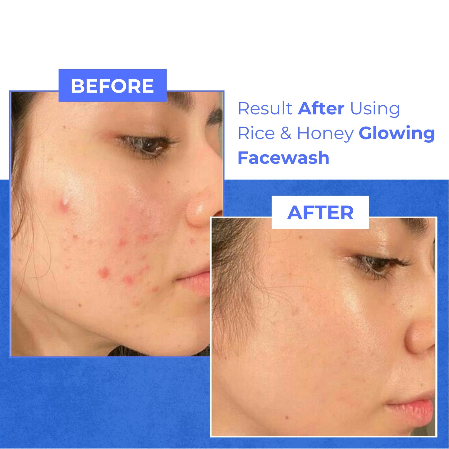 Glowing FaceWash Refresh and Oil Control