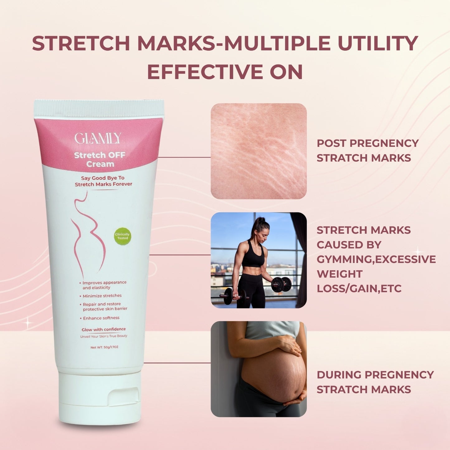 Glamly Stretch OFF Cream | Say Good Bye To Stretch Marks Forever