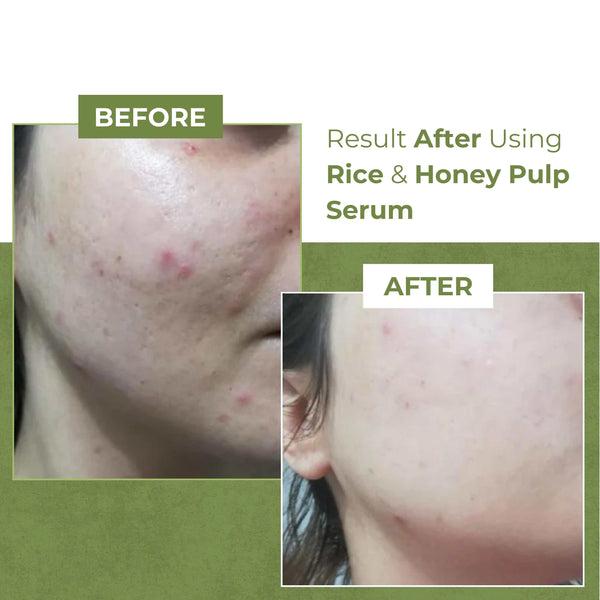 Rice and Honey Pulp Serum Repair and Radiance Boost