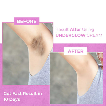 Underarm Glow Cream Bright and Fresh Skin