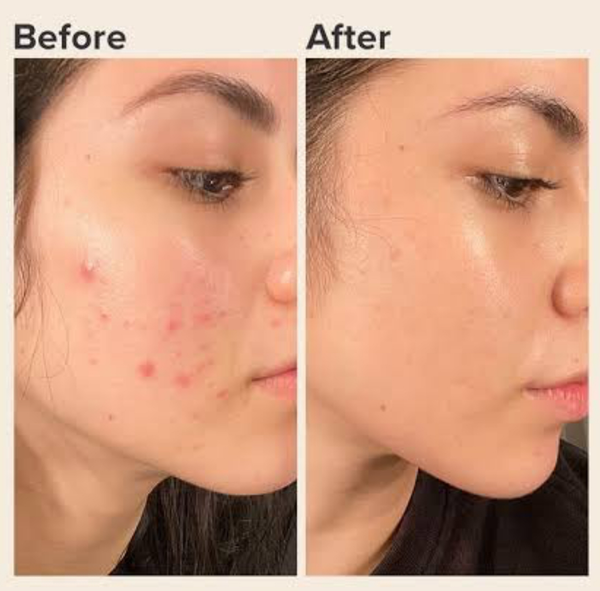 Glamly Brightening Cream