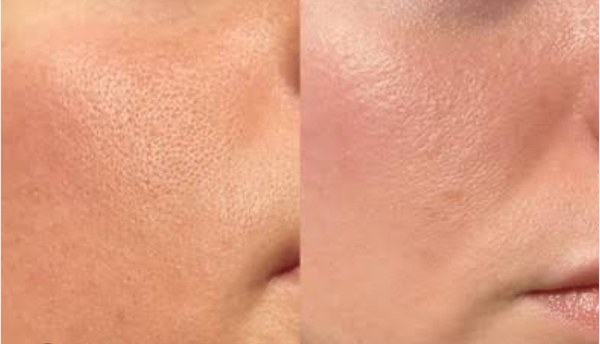 Glamly Brightening Cream