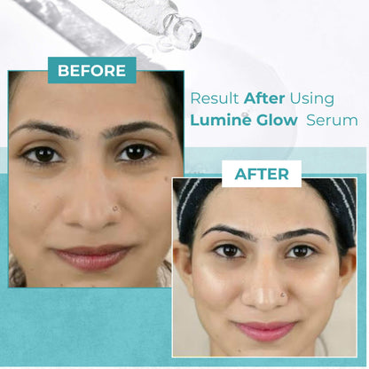 Glamly Lumine Glow Serum - 2