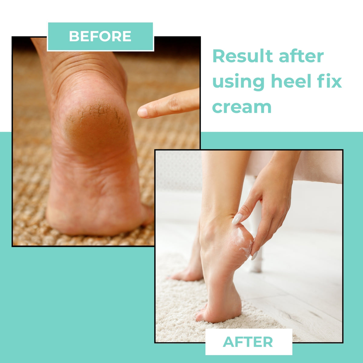 Heel Fix Cream For Cracked And Rough Feets - 6