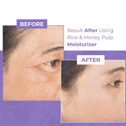 Rice and Honey Pulp Moisturizer - 2