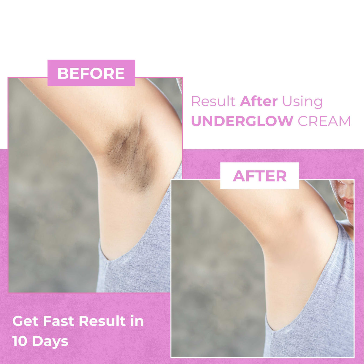 Underarm Glow Cream Bright and Fresh Skin - 2
